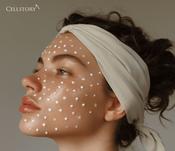 Cell Story Liquid Needling