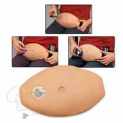Injection Belly
