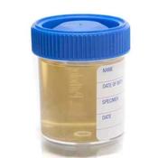 Specimen cup image
