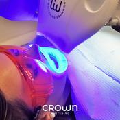 Exam, Teeth Clean and CW In-Office Whitening Voucher