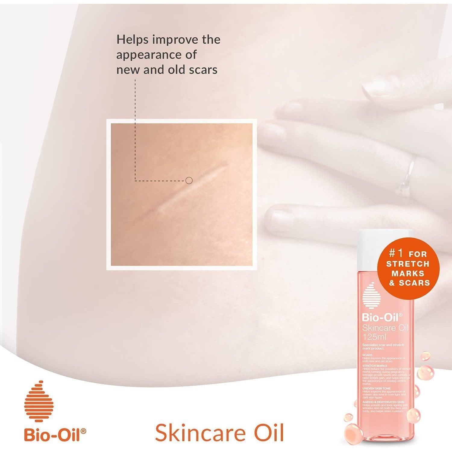 Bio-Oil Skincare Oil 60ml - Improves Scars, Stretch Marks, Uneven Skin Tone, Aging & Dehydrated Skin