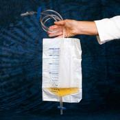 Dct Urine Bag 2.0 Litre - Sterile, with Inflow Valve - Pack of 50