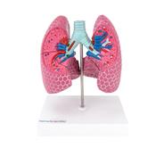 Lung Anatomy Model with Diseases