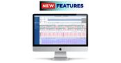 Norav Holter ECG Analysis High End Software
