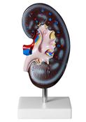 Life Size Kidney Model