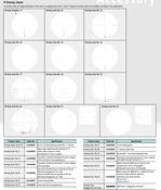 Overlay chart for Projector staggered cross-hairline Ø 312 mm 12AAM599 image