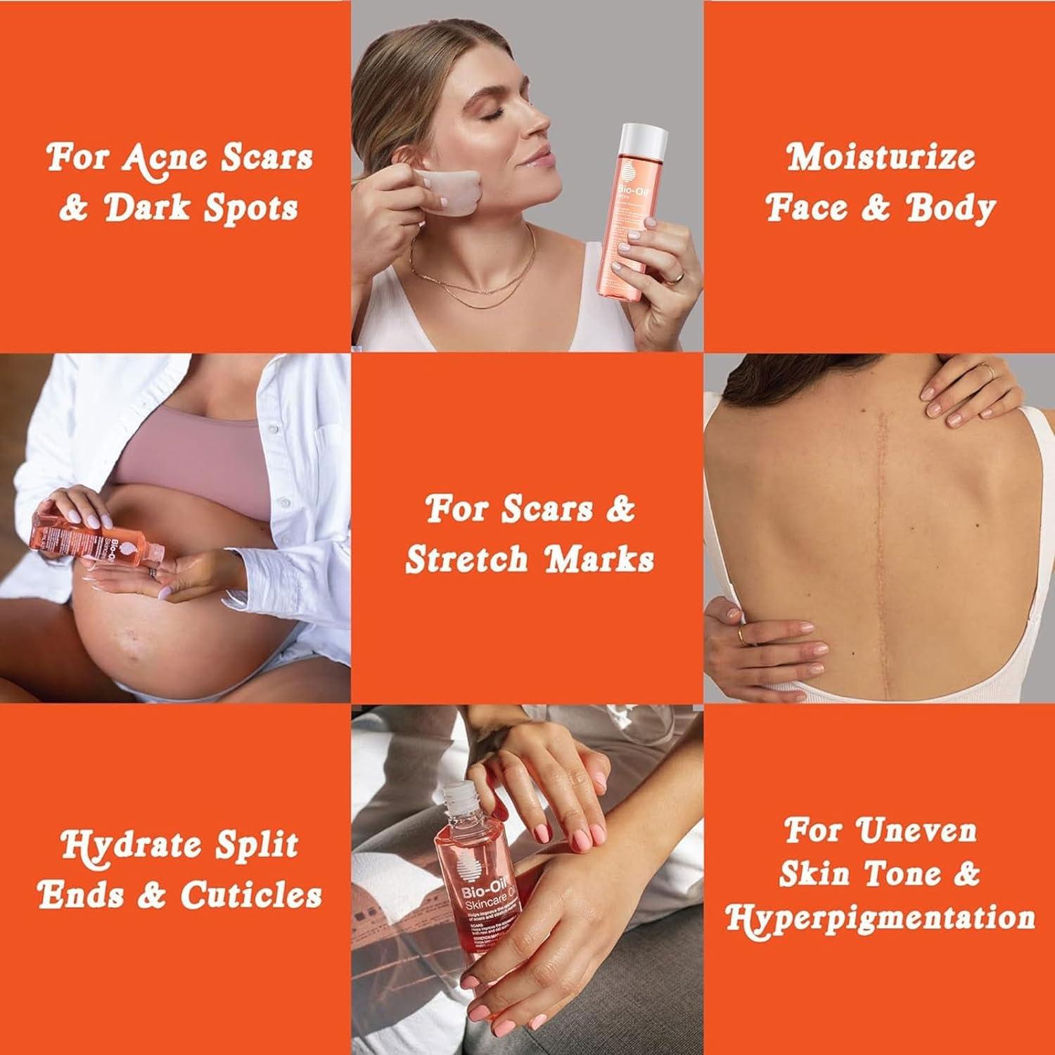 Bio-Oil Skincare Oil 60ml - Improves Scars, Stretch Marks, Uneven Skin Tone, Aging & Dehydrated Skin