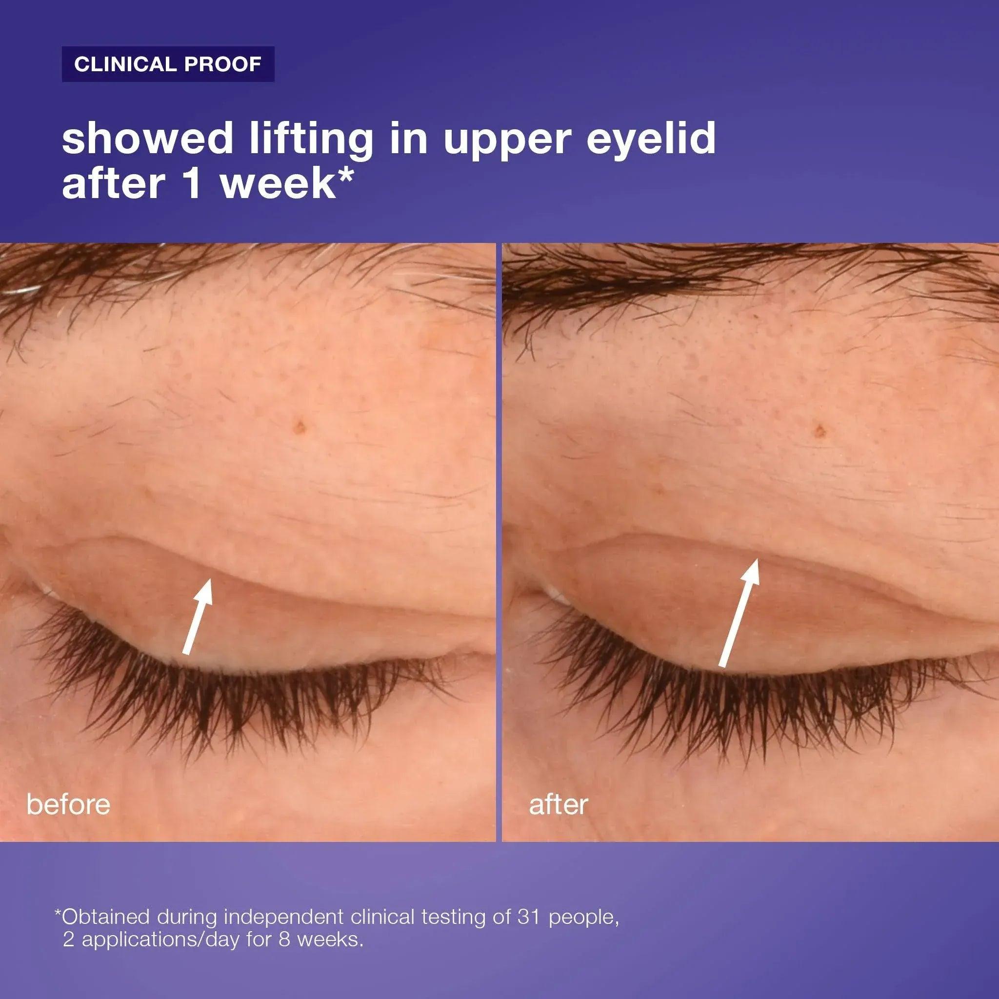Dermalogica Phyto Nature Lifting Eye Cream 15ml lifting firming eye treatment