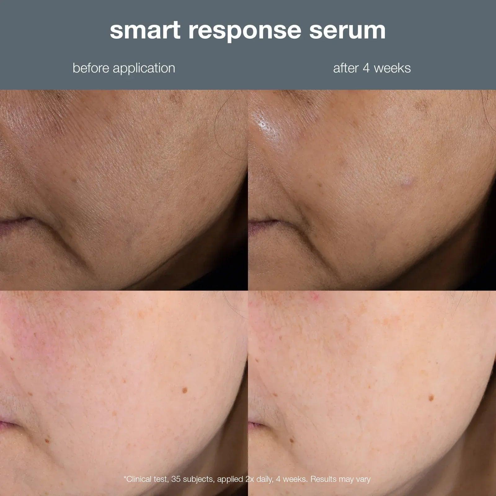 Dermalogica Smart Response Serum 30ml - Hydrates, Firms, Brightens & Soothes