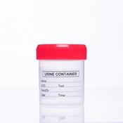 Urine Sample Container (50ml) image