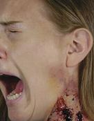 Woochie Werewolf Bites image