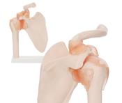 Shoulder Joint Anatomical Model