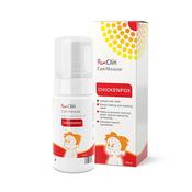 PoxClin Cool Mousse For Chickenpox 100ml image