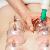 Deep Tissue Cupping Massage image
