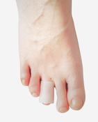 PEDECARE Cut Gel Toe Tube