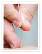 Dry Needling image