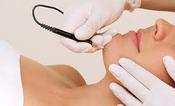 Apilus (large area) - Course of 6 treatments
