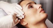 Mesotherapy Two Areas - Course of 3 treatments