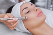 Microdermabrasion - Course of 4 treatments