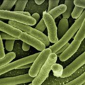 Legionella Test - Lab Sampling Kit For Mains Water image