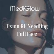 Exion RF Needling Full Face &amp;amp; Neck
