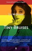 Tiny Bruises by Liz McManus