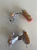 Palate free dentures image